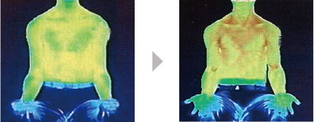 thermography